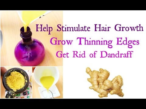 How to Grow Hair Long Thick & Healthy Fast | Natural Remedy with Ginger Root Hair loss and Dandruff